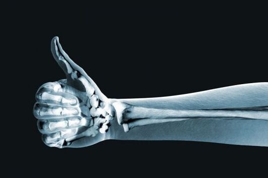 X-rays to diagnose pain in the finger joints