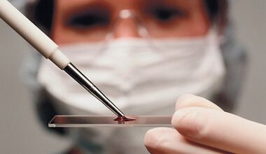 Diagnosis of differential attributes and arthrosis